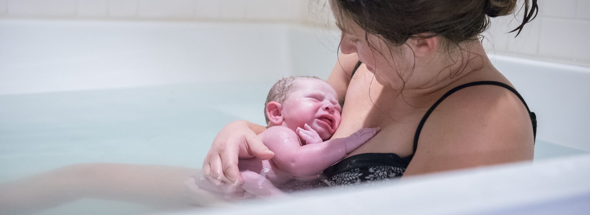 Parto Natural Ou Com Epidural? Saiba O Que Esperar